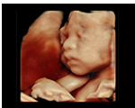 28w